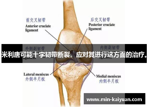 米利唐可能十字韧带断裂，应对其进行这方面的治疗。